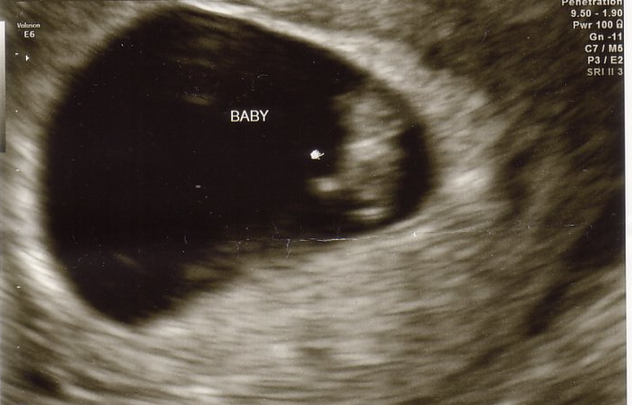 Yes this is an actual sonogram of my second daughter. You've now all violated the sacredness of her birth. How. dare. you.